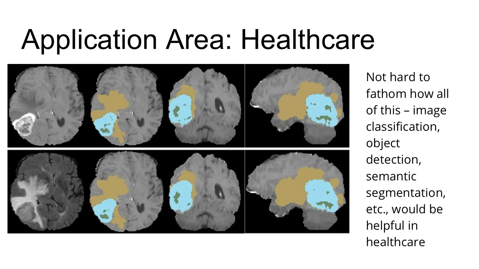 Application slide on healthcare showing brain scans with segmented regions.